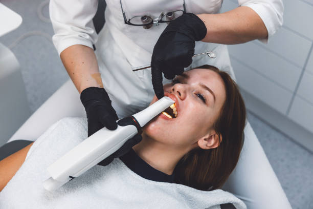Best Emergency Wisdom Tooth Extraction in La Mirada, CA